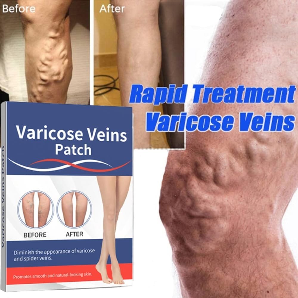PARCHE MEDICINAL PARA VARICES - Imagen 10
