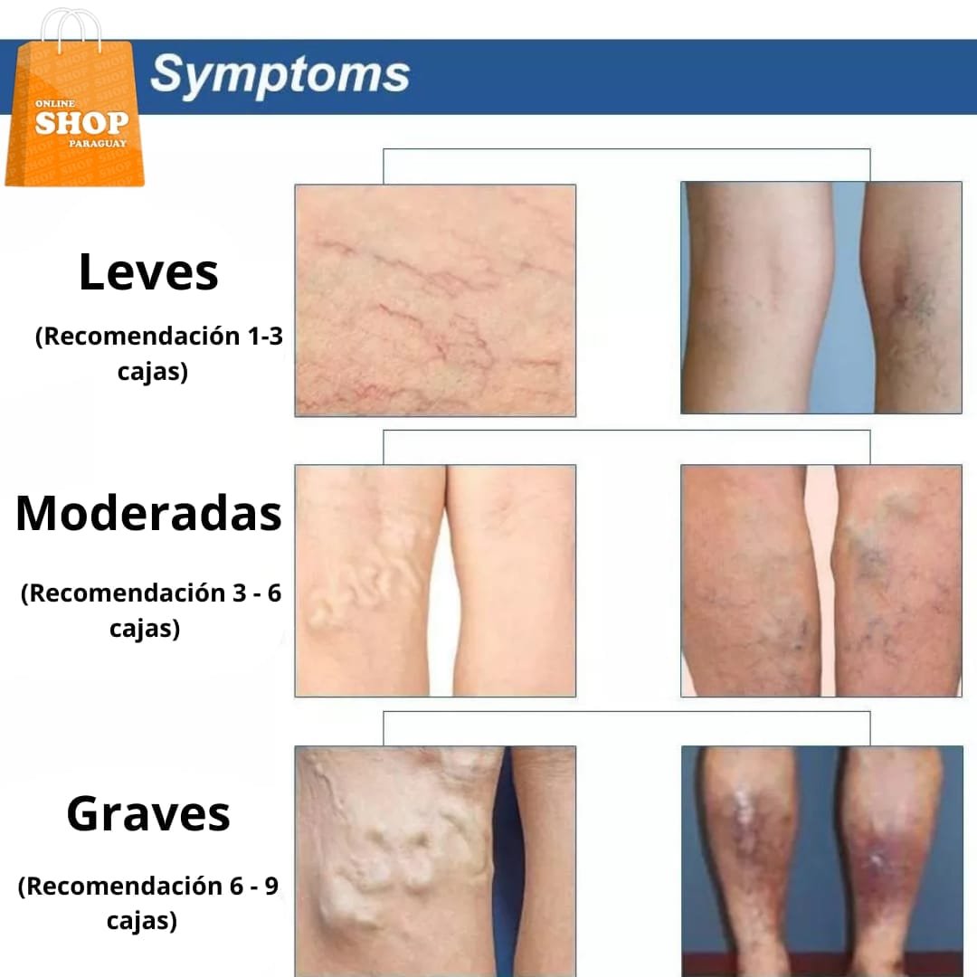 PARCHE MEDICINAL PARA VARICES - Imagen 6